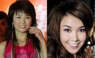 爆料娱乐圈整容,揭秘明星整容真相与争议